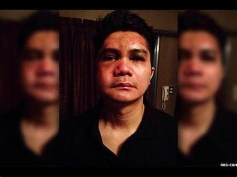 vhong navarro bugbog|Vhong Navarro, bugbog sarado sa mga kuhang larawan.
